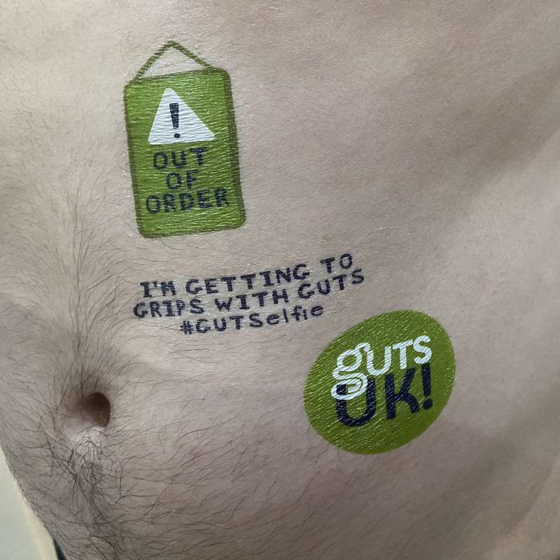 How Guts UK Raised Money For Their Charity